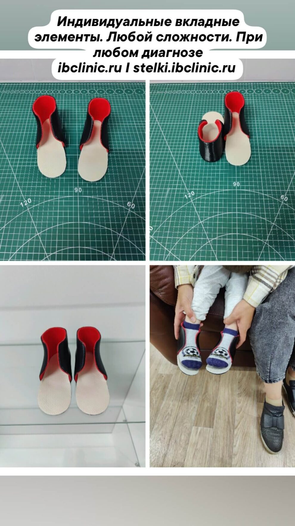 3Д ортопедические вкладыши с боковой поддержкой