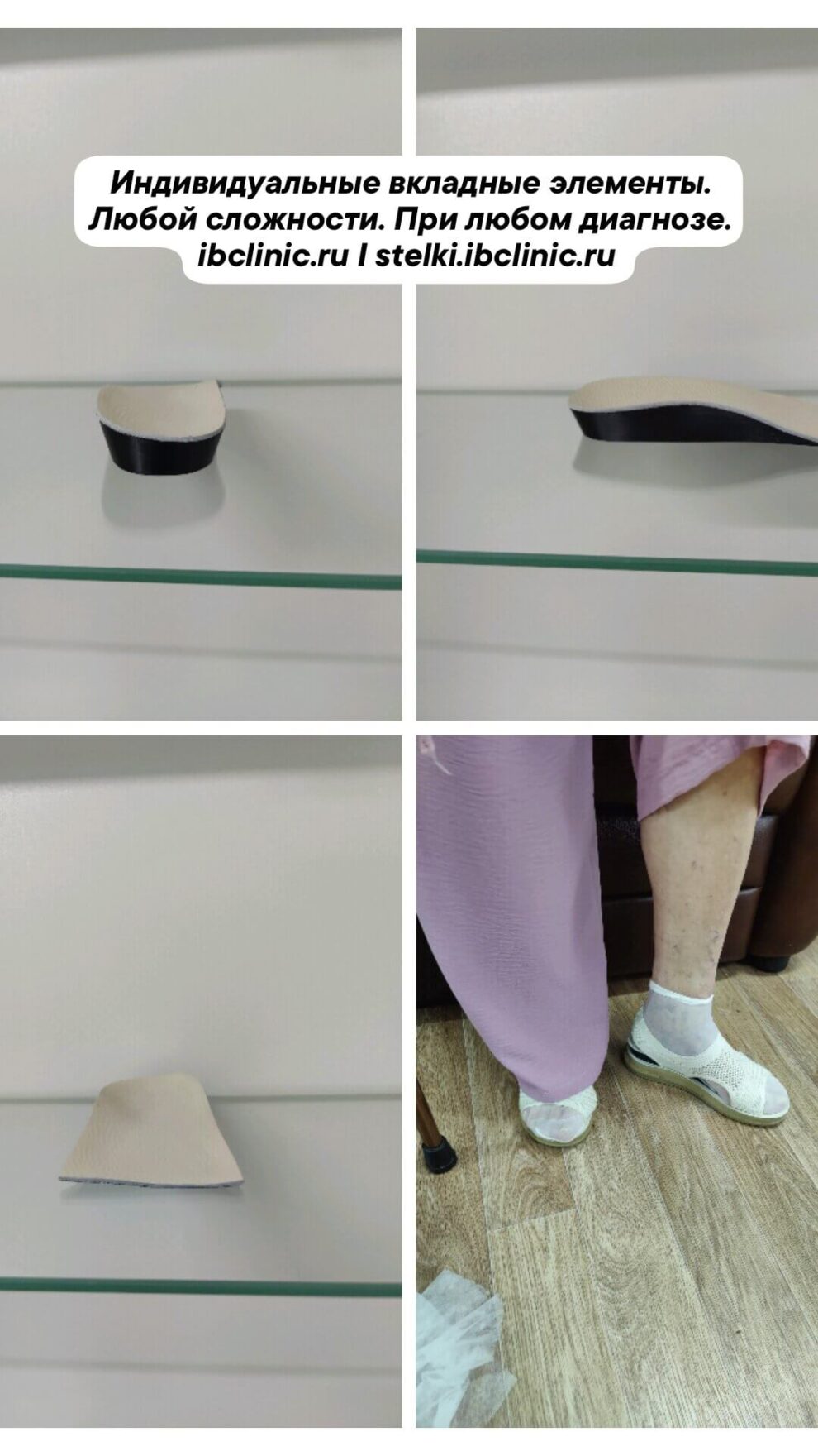 3Д ортопедические вкладыши с компенсацией укорочения